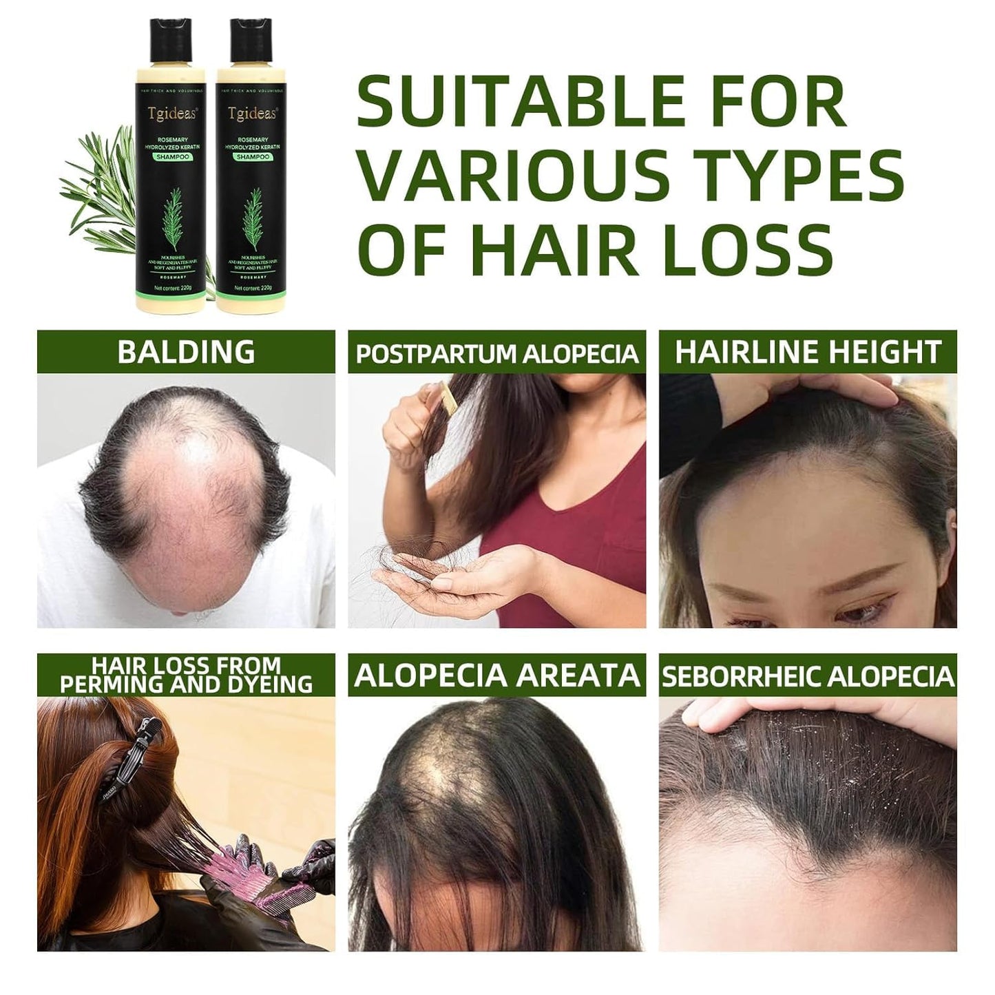 ⏰Limited stock!🌿 Rosemary Hydrolyzed Keratin Shampoo