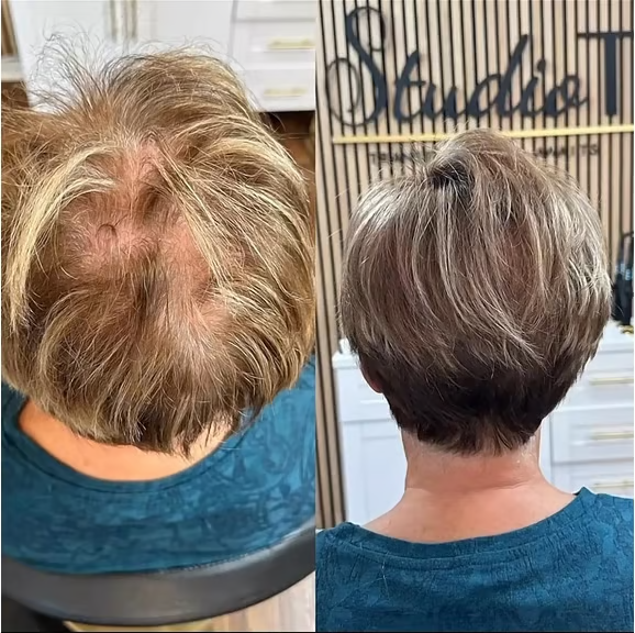 🔥Only $16.99 Last Day 💥Breathable Natural Hair Tips for Women with Thinning Hair