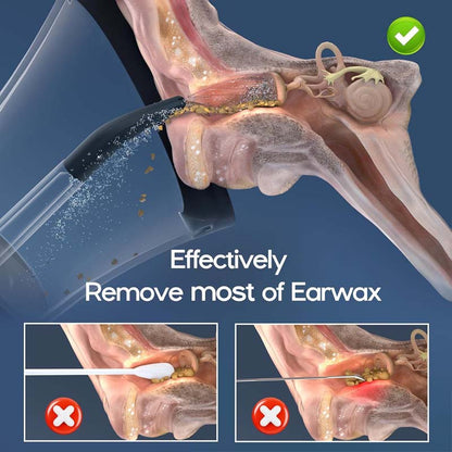 Electric Ear Wax Removal