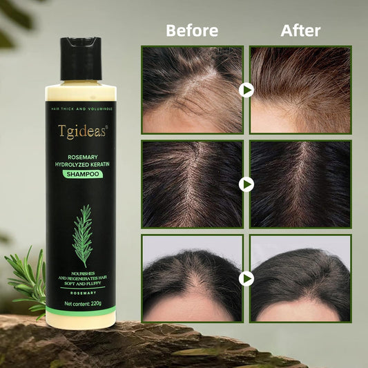 ⏰Limited stock!🌿 Rosemary Hydrolyzed Keratin Shampoo